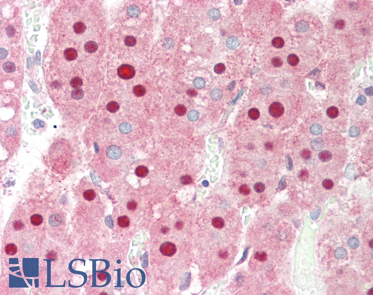 IHC-plus™ Polyclonal Chicken anti-Human PIN1 Antibody (IHC, IF, WB)