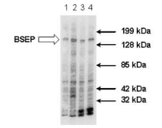 IHC-plus™ Monoclonal Mouse anti-Human ABCB11 / BSEP Antibody (aa705-718, IHC, WB)