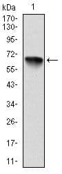 RPS6KA3 / RSK2 Antibody (clone 40000000000)