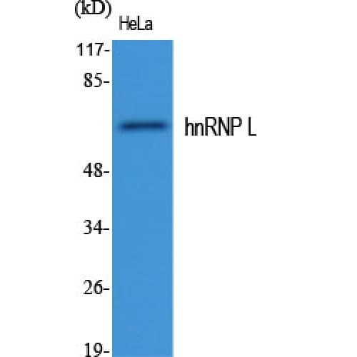 HNRNPL / hnRNP L Antibody (30-110 aa, Internal)