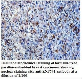 ZNF791 Antibody (aa57-314)