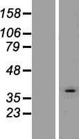 AGPAT3 Protein (Over-Expression Lysate Myc-DDK (Flag))