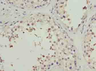 IHC-plus™ Polyclonal Rabbit anti-Human PPP1R14A / CPI-17 Antibody (IHC)