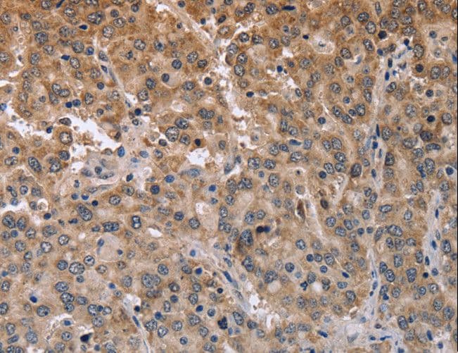 MAPRE3 / EB3 Antibody