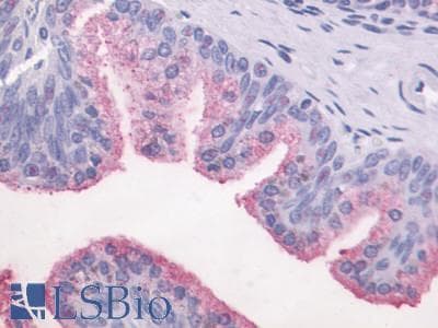 PathPlus™ Polyclonal Rabbit anti-Human GPR87 Antibody (C-Terminus, IHC)
