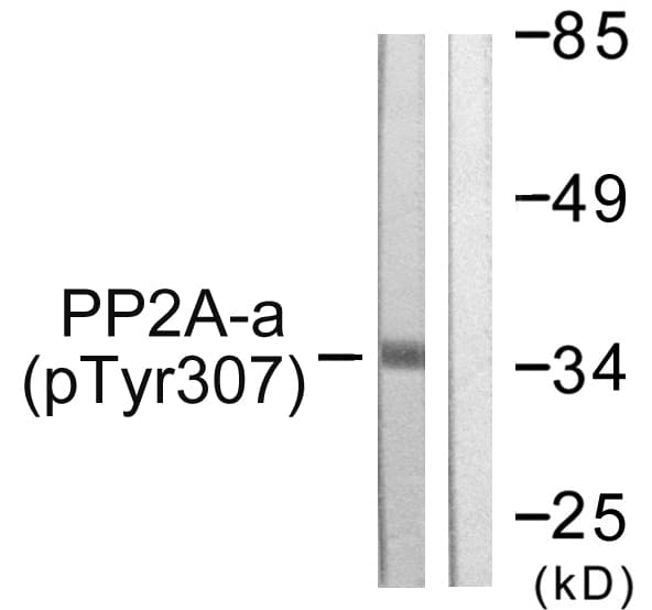 PP2Ac / PPP2CA Antibody (phospho-Tyr307)