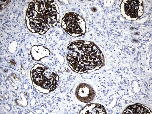 Monoclonal Mouse anti-Human MME / CD10 Antibody (clone UMAB236, Carrier-free, aa411-750, IHC, WB)