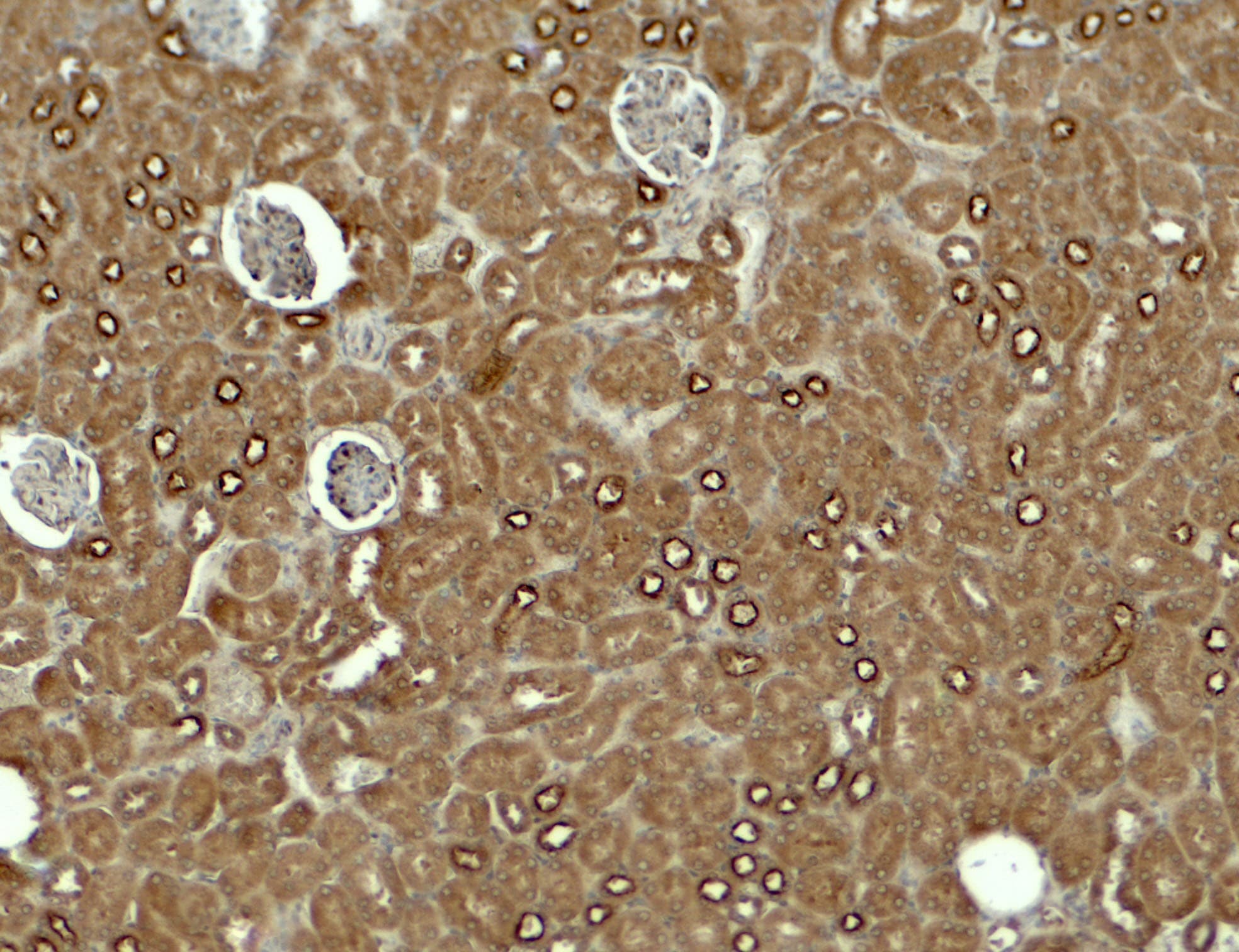 Polyclonal Rabbit anti-Human NEPH2 / KIRREL3 Antibody (IHC, IF, WB)