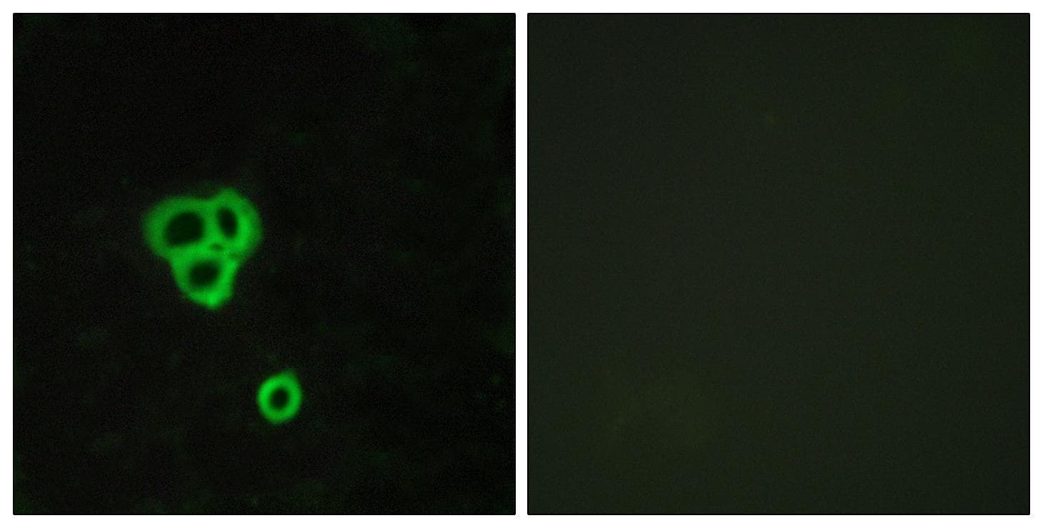 GPR119 Antibody