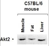 Polyclonal Rabbit anti-Human AKT2 Antibody (aa450-475, WB)