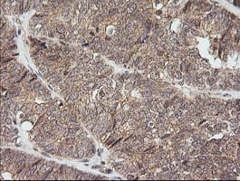 NKIRAS1 Antibody (clone OTI6C11)