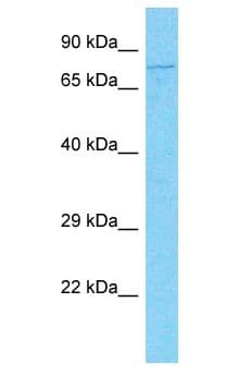 Polyclonal Rabbit anti-Human IFI16 Antibody (aa386-435, WB)