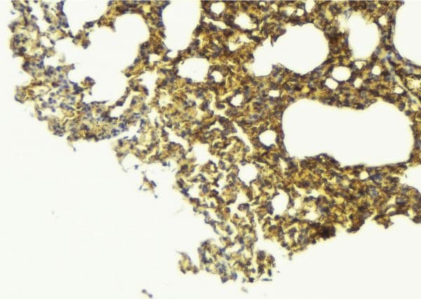 SCNN1B / ENaC Beta Antibody