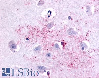 PathPlus™ Polyclonal Rabbit anti-Human PAK6 Antibody (Linker Domain, IHC)