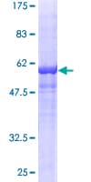 Human RPLP0 Protein (Recombinant GST)