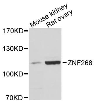 Polyclonal Rabbit anti-Human ZNF268 Antibody (WB)