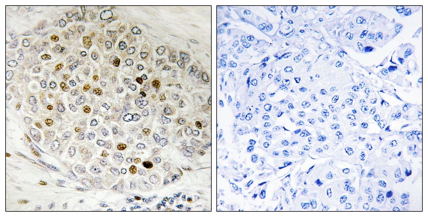 Polyclonal Rabbit anti-Human HDAC5 Antibody (aa464-513, IHC, WB)
