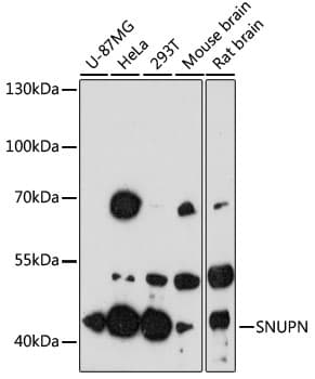 Polyclonal Rabbit anti-Human SNUPN Antibody (WB)