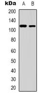 Polyclonal Rabbit anti-Human ZC3H7B Antibody (C-Terminus, IHC, WB)