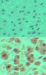 Polyclonal Rabbit anti-Human POU2F1 / OCT1 Antibody (aa1-50, IHC, WB)