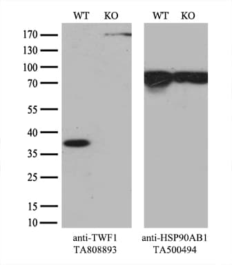Monoclonal Mouse anti-Human TWF1 / PTK9 Antibody (clone OTI1C2, aa140-384, WB)