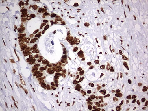 Monoclonal Mouse anti-Human HNRPM / HNRNPM Antibody (clone OTI1F6, aa1-261, IHC, WB)