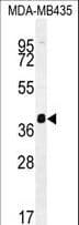 HNRNPCL1 Antibody (aa252-281)