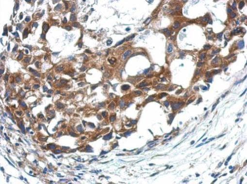 APAF1 / APAF-1 Antibody (aa1051-1248)