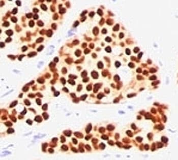 ER Alpha / Estrogen Receptor Antibody (aa2-185, clone SPM567, Azide-free, BSA-free)