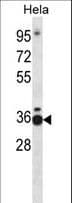 Polyclonal Rabbit anti-Human TCEA1 / TFIIS Antibody (aa98-126, IHC, WB)