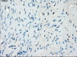PRKAR1A Antibody (clone OTI6C7)