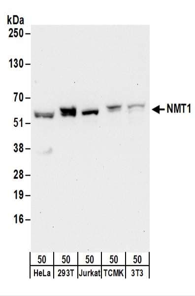 IHC-plus™ NMT1 Antibody (aa50-100)