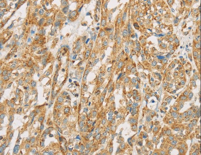 NPPB / BNP Antibody