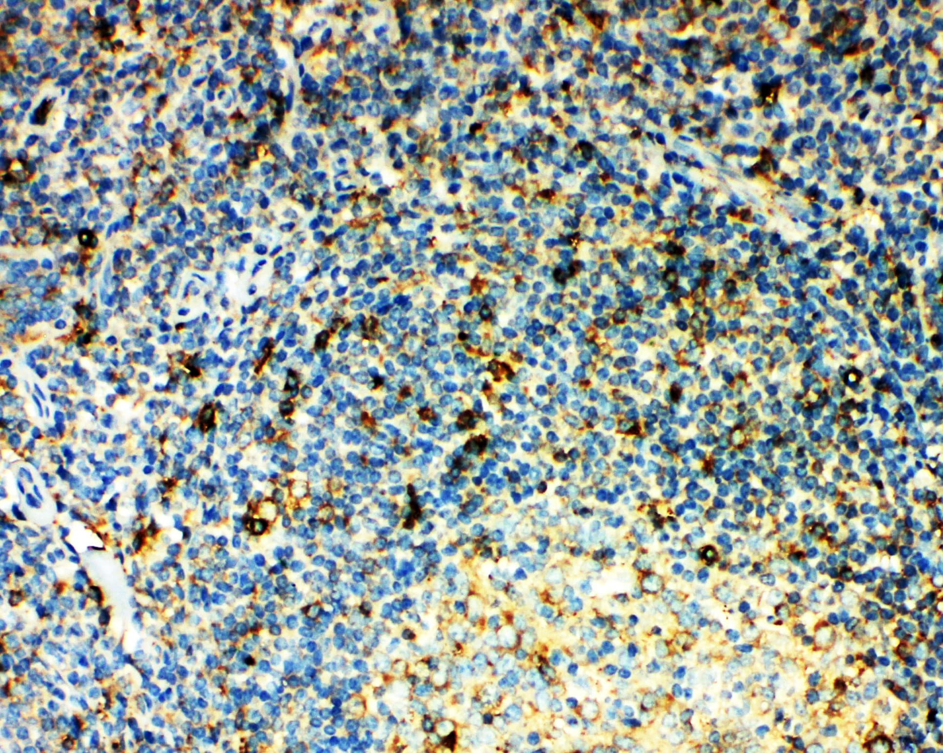 Polyclonal Rabbit anti-Human CCR3 Antibody (aa1-20, IHC, WB)