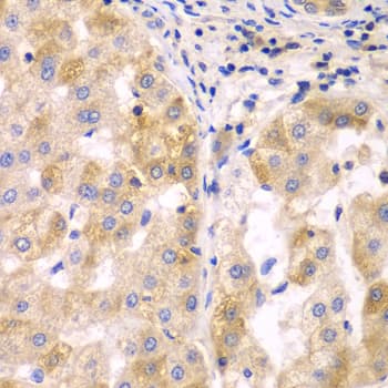 SULT2B1 / Sulfotransferase 2B1 Antibody