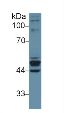 KRT23 / Keratin 23 Antibody (aa243-382)