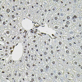 Polyclonal Rabbit anti-Human CTNNB1 / Beta Catenin Antibody (IHC, WB)