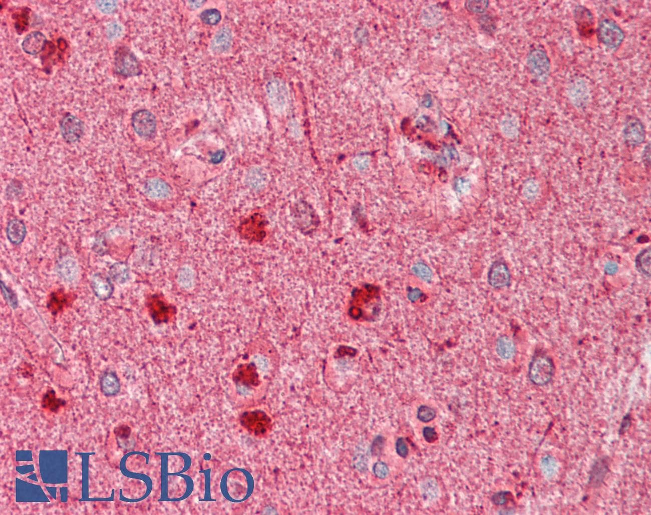 IHC-plus™ DCX / Doublecortin Antibody (clone 2G5)