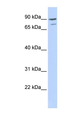 AKAP8 / AKAP95 Antibody (aa539-588)