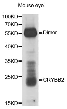 Monoclonal Rabbit anti-Human CRYBB2 Antibody (IHC, WB)