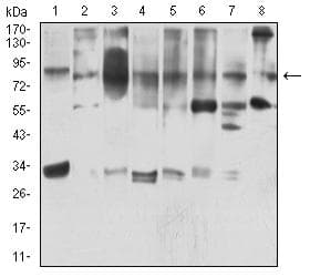 MYST2 / HBO1 Antibody (clone 4E12H12)