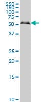 SMAD1 Antibody (clone 2E9)