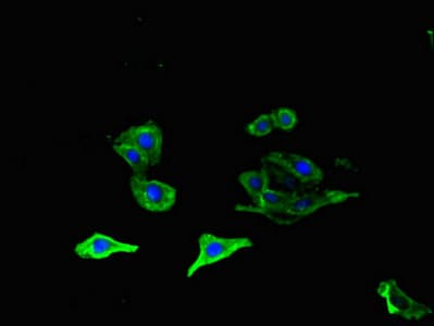 Polyclonal Rabbit anti-Human OLFML1 Antibody