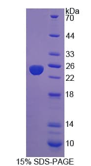 Human PTP4A3 Protein (Recombinant His)