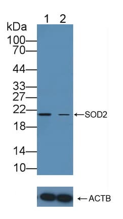 SOD2 / Mn SOD Antibody (aa25-222)