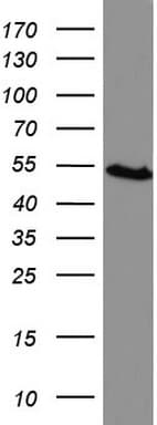 HMBS / PBGD Antibody (clone UMAB144)