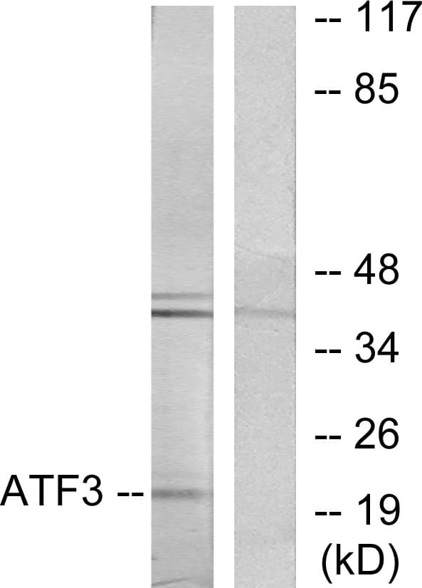 ATF3 Antibody (aa131-180)