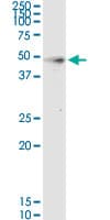 HPN / TMPRSS1 / Hepsin Antibody (clone 2D5)