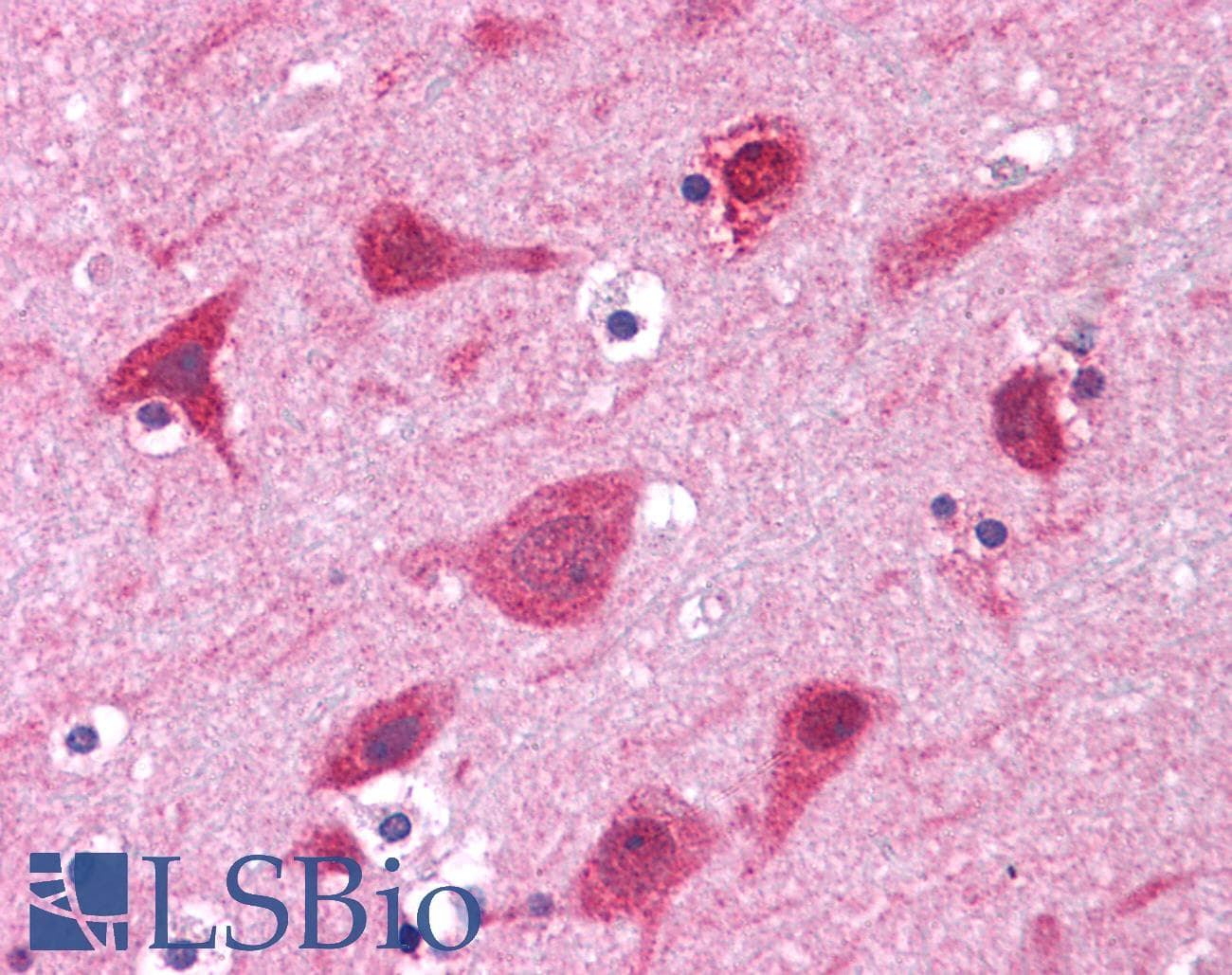IHC-plus™ Polyclonal Rabbit anti-Human GRB2 Antibody (clone Polyclonal, C-Terminus, IHC, WB)