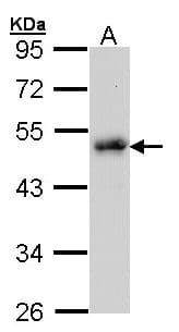Polyclonal Rabbit anti-Human LDB1 / CLIM2 Antibody (aa86-411, IHC, WB)